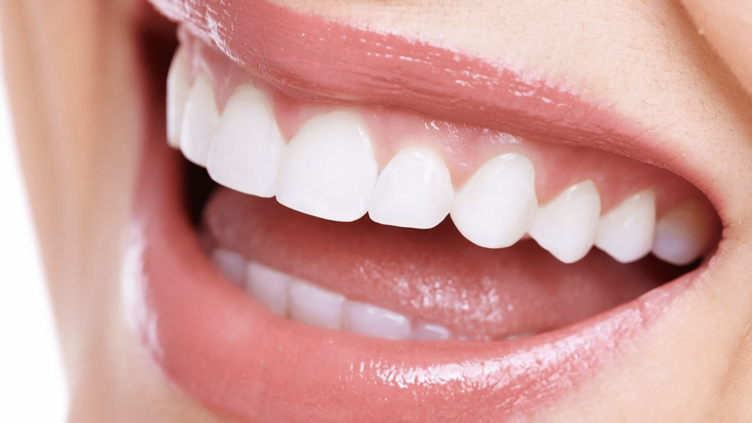 close up of a teeth with teeth whitening treatment